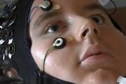 El síndrome del cautiverio provoca la inmovilidad total del cuerpo pese a que se mantiene intacto su nivel de conciencia y sus funciones cerebral