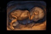 Ecografía 4D de un feto de 14 semanas. Imagen: captura vídeo Youtube canal Rafael Ortega Muñoz, ginecólogo.