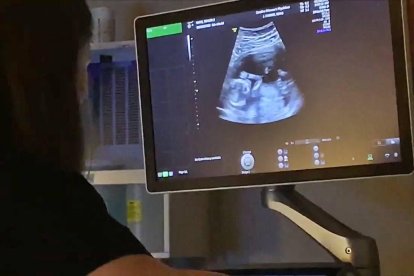 La ciencia del desarrollo embrionario se ha convertido en una gran aliada de la lucha provida. En la imagen, ecografía de un embarazo de 14 semanas.