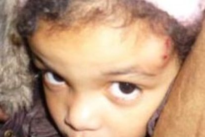 Niña de 4 años atacada por una banda de abortistas