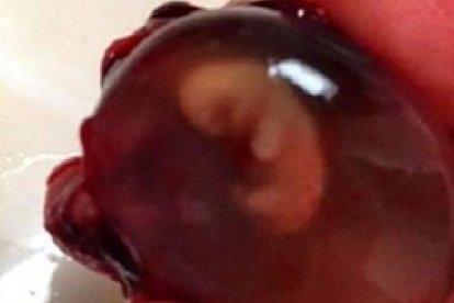 Ya tenía nombre, David Raphael, y pudo tener sepultura, como quería su madre.