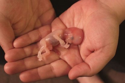 Noah a las 12 semanas de gestación