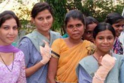 Muchachas con lepra en la India, el país con más enfermos... la detección precoz es muy importante