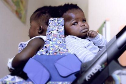 Las gemelas centroafricanas antes de ser separadas en una operación especialísima en el Hospital infantil de la Santa Sede