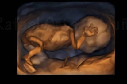 Ecografía 4D de un feto de 14 semanas. Imagen: captura vídeo Youtube canal Rafael Ortega Muñoz, ginecólogo.