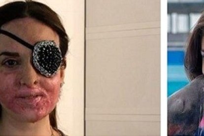 El antes y el después de Gessica