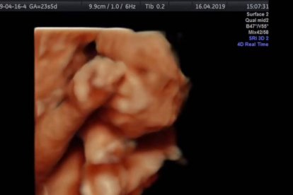 Feto de seis meses, visto en una ecografía 3D. Esta semana, en Colombia se ha establecido el derecho a darle muerte incluso sin alegar causa alguna.