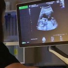 La ciencia del desarrollo embrionario se ha convertido en una gran aliada de la lucha provida. En la imagen, ecografía de un embarazo de 14 semanas.