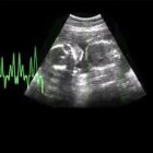 Imagen del vídeo de la campaña Majestad no firme