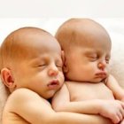 Gemelos: unidos antes y después.