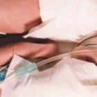 Tenían 3 semanas de vida, nacieron prematuras, una de ellas se moría, la otra la abrazó... y la salvó