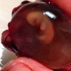 Ya tenía nombre, David Raphael, y pudo tener sepultura, como quería su madre.