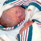 Las dos pequeñas nacieron sanas y siguen sanas, y ahora su historia prenatal se ha convertido en viral gracias al espectacular vídeo de la operación que las salvó.