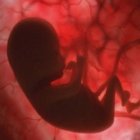 En Austria reconocen la personalidad jurídica de los no nacidos