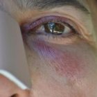 La religiosa en una foto detalle de sus heridas - ella desconocía por completo al agresor