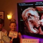 Los padres Carissa y Randy posan junto a la sorprendente imagen de la ecografía