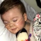 Alfie Evans en una foto del 25 de abril de 2018 - le quitaron el tubo pero respira