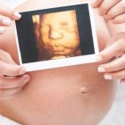 En Kentucky cualquier mujer que quiera abortar tiene que ver una ecografía de su bebé y escuchar el latido de su corazón