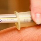 El número de muertes por eutanasia no ha dejado de aumentar en Holanda, de forma paralela a la ampliación, cada vez más discrecional, de las causas que la permiten.