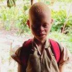 Lambert es un niño albino de Burundi, donde sufren persecución y violencia - un programa de la Infancia Misionera ayuda a estos niños