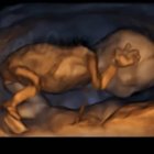 Ecografía 4D de un feto de 14 semanas. Imagen: captura vídeo Youtube canal Rafael Ortega Muñoz, ginecólogo.