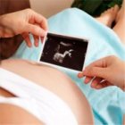 Ecografía de un embarazo