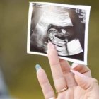 Teo nació a las 25 semanas de gestación, sobrevivió y tras un tiempo en el hospital se fue a casa con sus padres y hermanos.