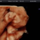 Feto de seis meses, visto en una ecografía 3D. Esta semana, en Colombia se ha establecido el derecho a darle muerte incluso sin alegar causa alguna.