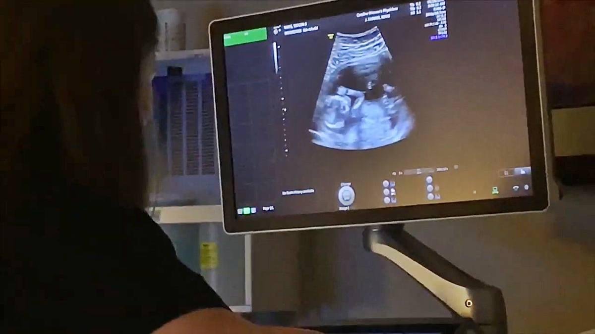 La ciencia del desarrollo embrionario se ha convertido en una gran aliada de la lucha provida. En la imagen, ecografía de un embarazo de 14 semanas.