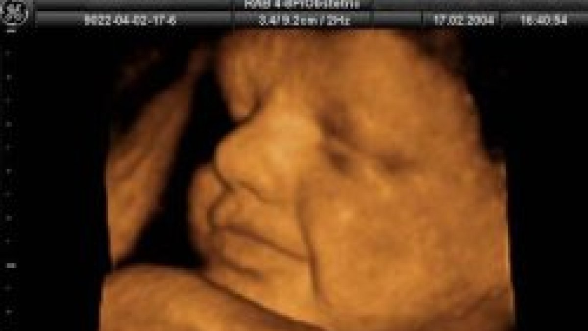 El número de abortos en España creció un 10 por ciento en 2007