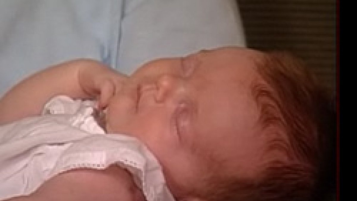 Una niña «nació dos veces» en EEUU tras serle extirpado un tumor