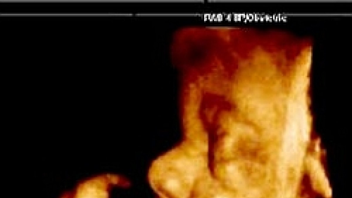 Un grupo de «expertos» en bioética de la Universidad de Barcelona piden el aborto libre