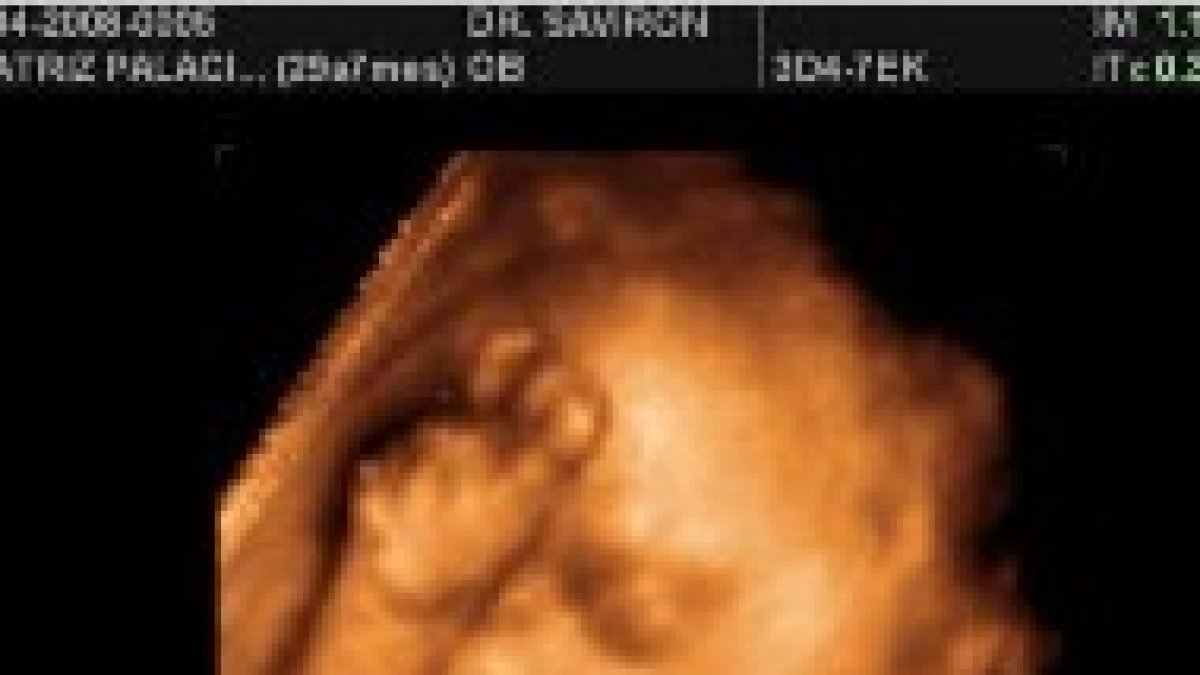 Ecografía en 3D de un feto