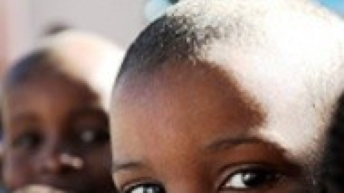 Un niño haitiano espera ser atendido tras el terremoto