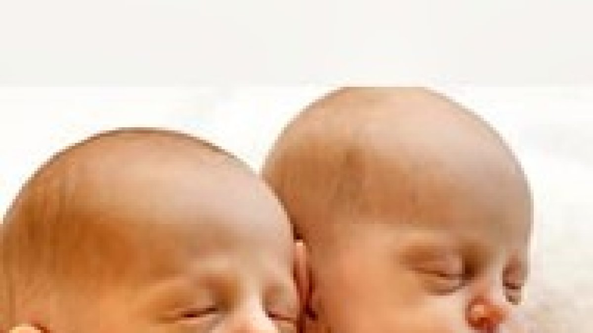 Gemelos: unidos antes y después.