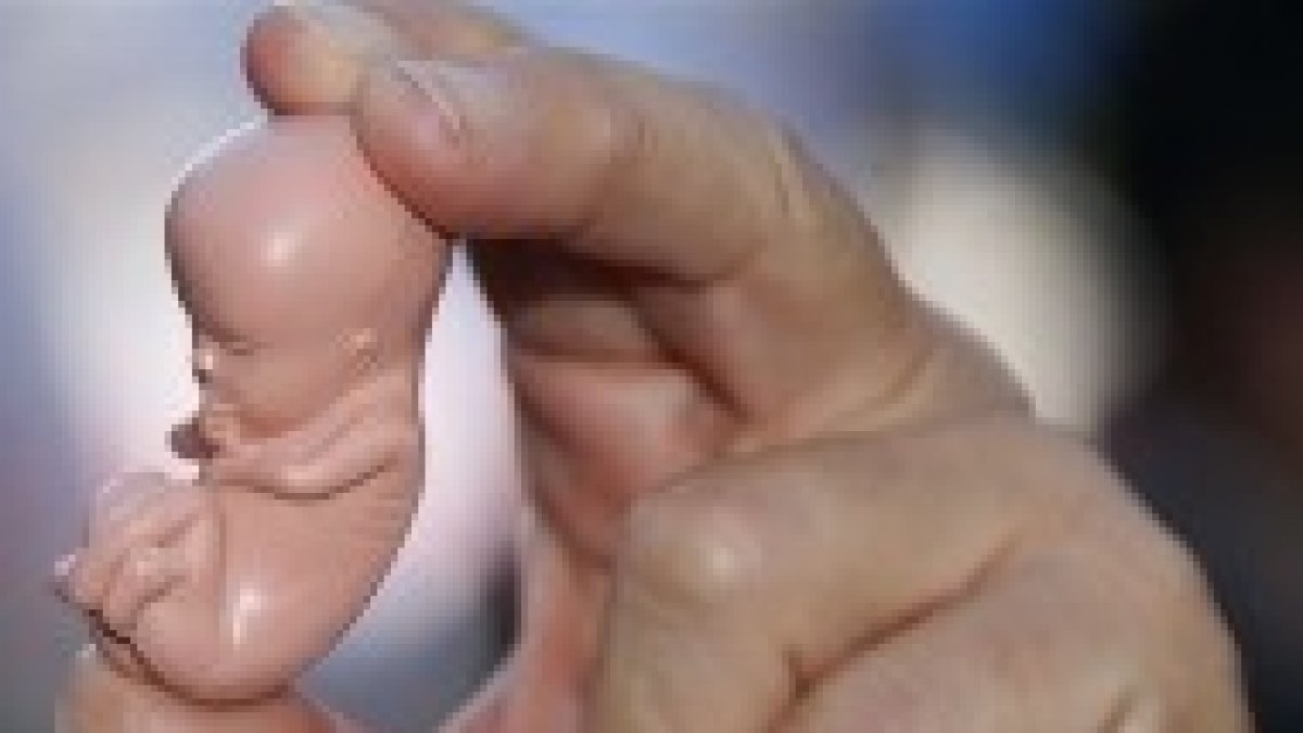 Es legal abortar bebés como este