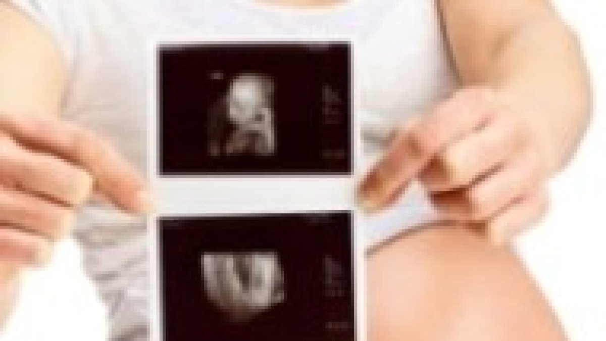 Ecografía y barriga a las 20 semanas