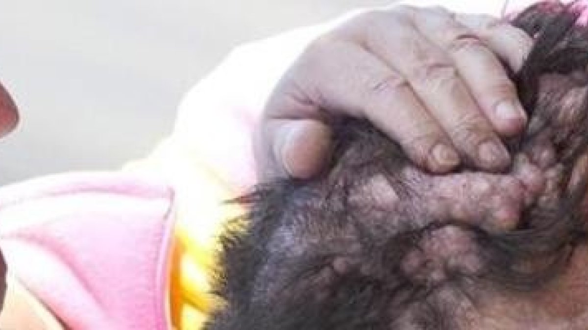 El Papa Francisco con un enfermo