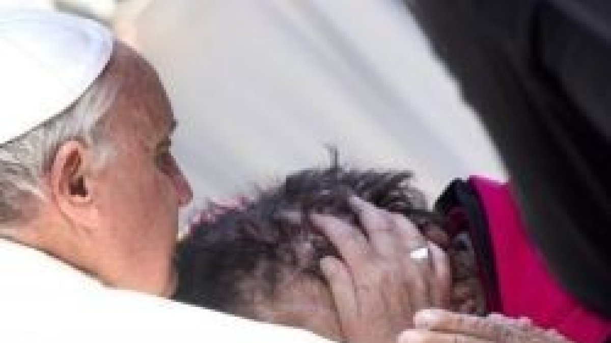 Francisco abraza a Vinicio, de rostro deformado por la enfermedad