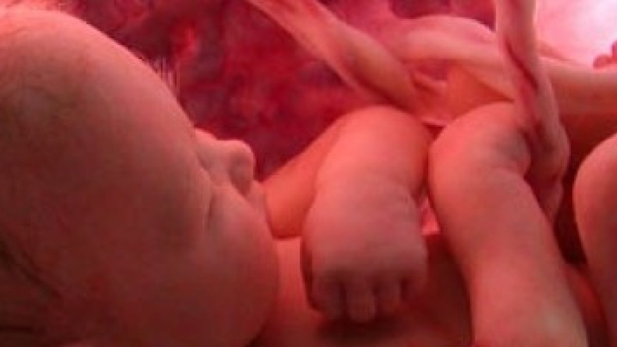 Un feto en el vientre de su madre