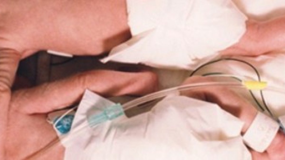 Tenían 3 semanas de vida, nacieron prematuras, una de ellas se moría, la otra la abrazó... y la salvó