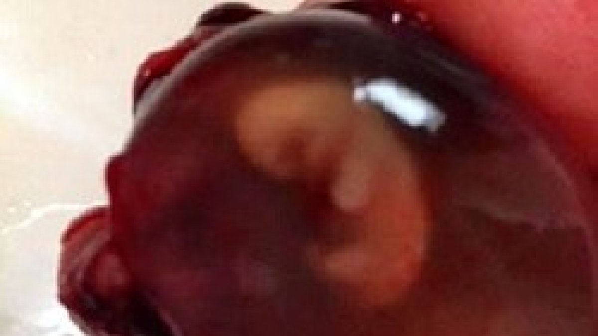 Ya tenía nombre, David Raphael, y pudo tener sepultura, como quería su madre.