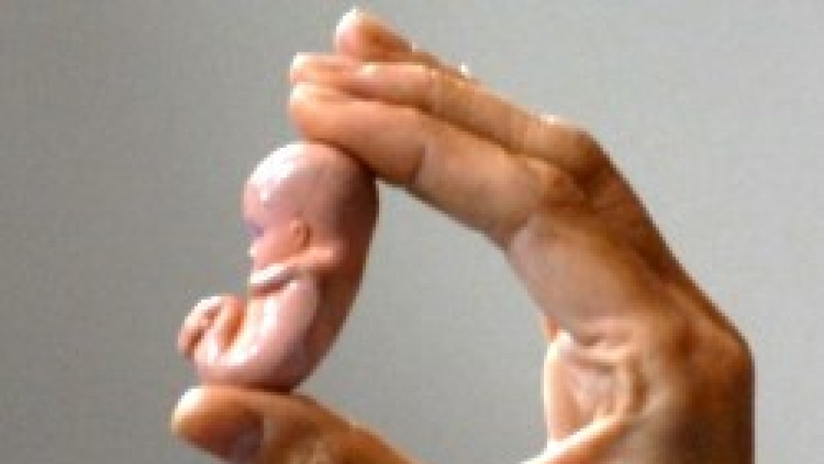 En el debate del aborto es difícil hacer visible al bebé, el más indefenso y perjudicado
