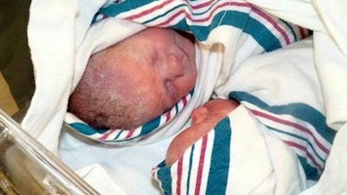 Las dos pequeñas nacieron sanas y siguen sanas, y ahora su historia prenatal se ha convertido en viral gracias al espectacular vídeo de la operación que las salvó.