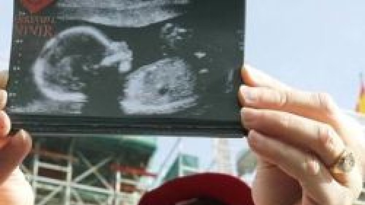 Derecho a Vivir convoca a Marchas por la Vida el 18 de junio y pide ecografías antes de abortar