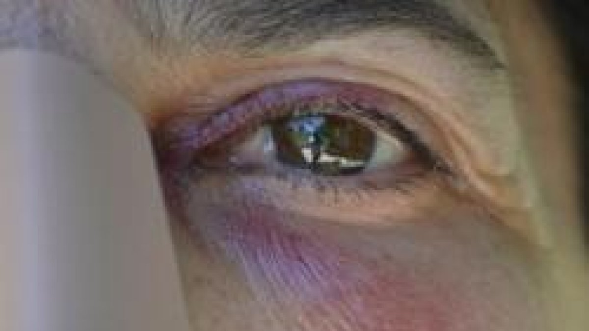 La religiosa en una foto detalle de sus heridas - ella desconocía por completo al agresor