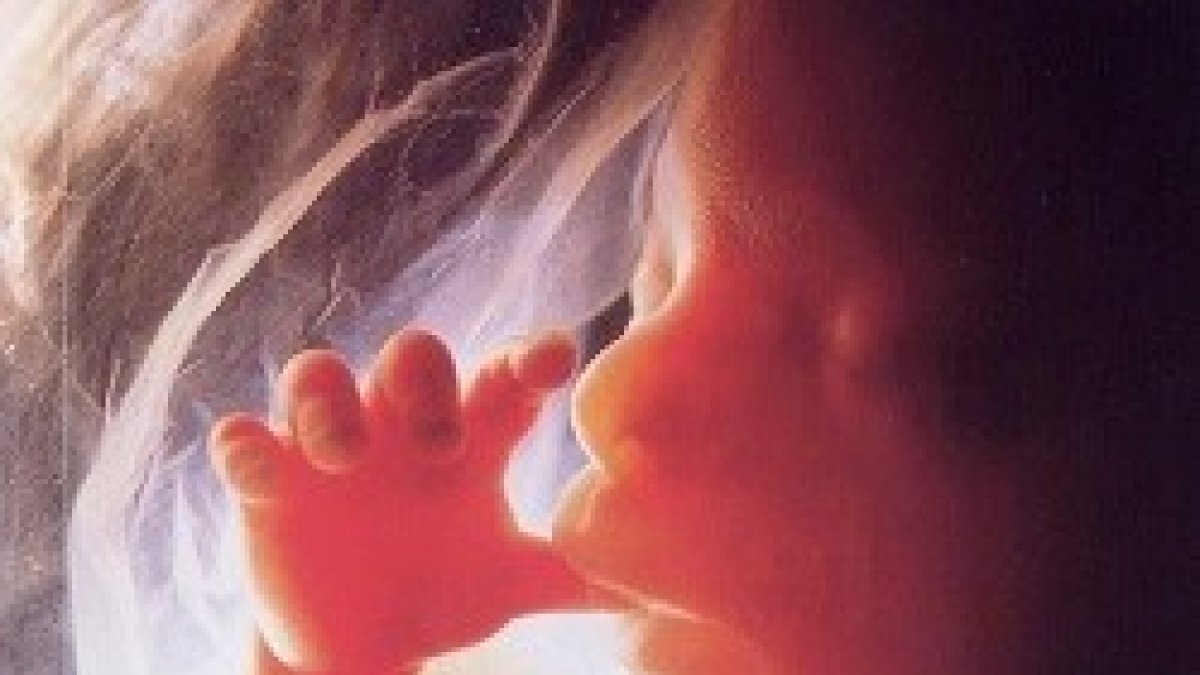 El proyecto pretende prohibir los abortos a partir de la semana 20