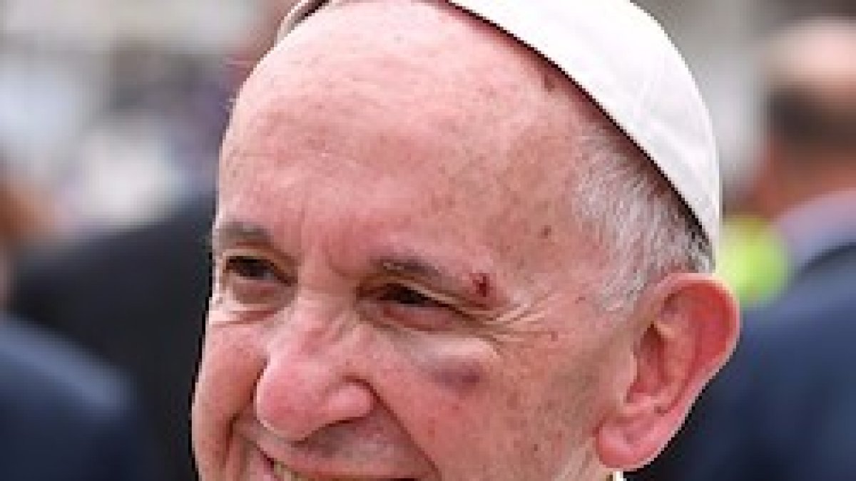 La cara del Papa refleja la contundencia del golpe.