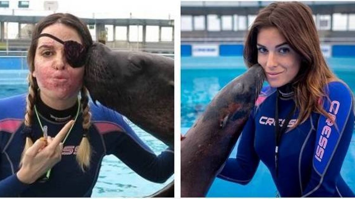 Gessica, antes y después del ataque de ácido que sufrió por el que era su exnovio