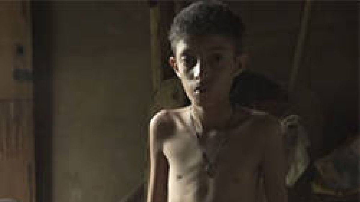 En Venezuela, en algunos lugares la desnutrición infantil afecta al 18% de los niños